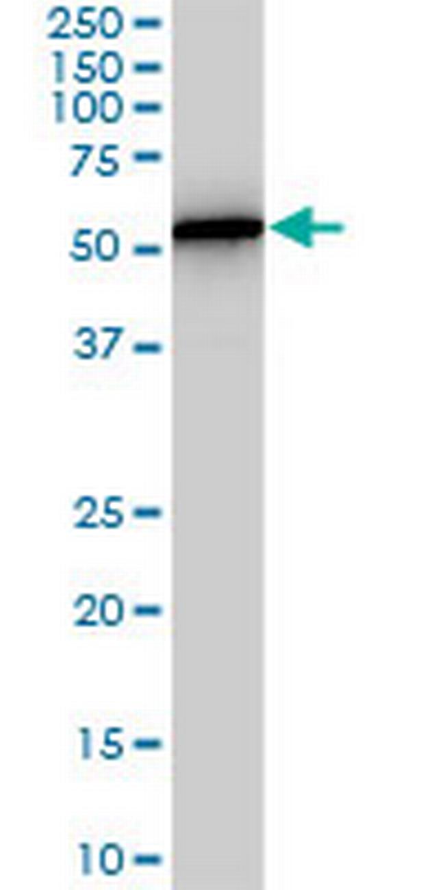 PHGDH Antibody in Western Blot (WB)