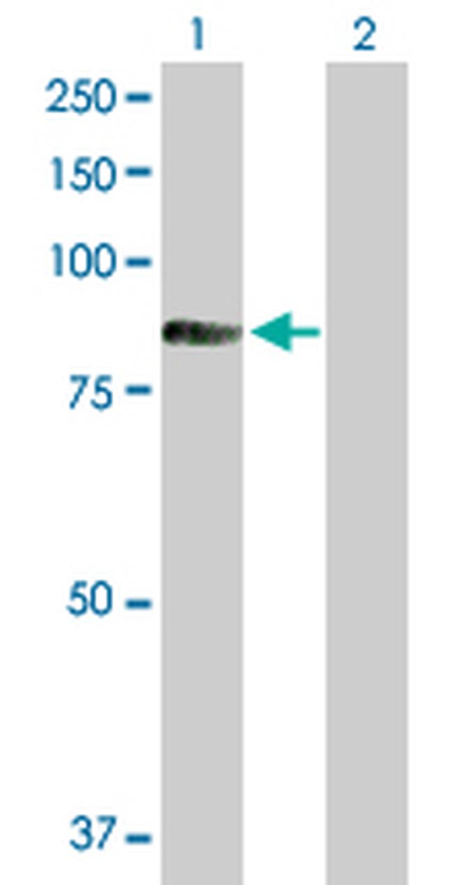 TIAM2 Antibody in Western Blot (WB)