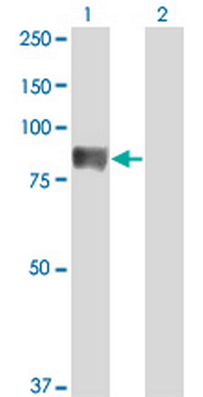 TIAM2 Antibody in Western Blot (WB)