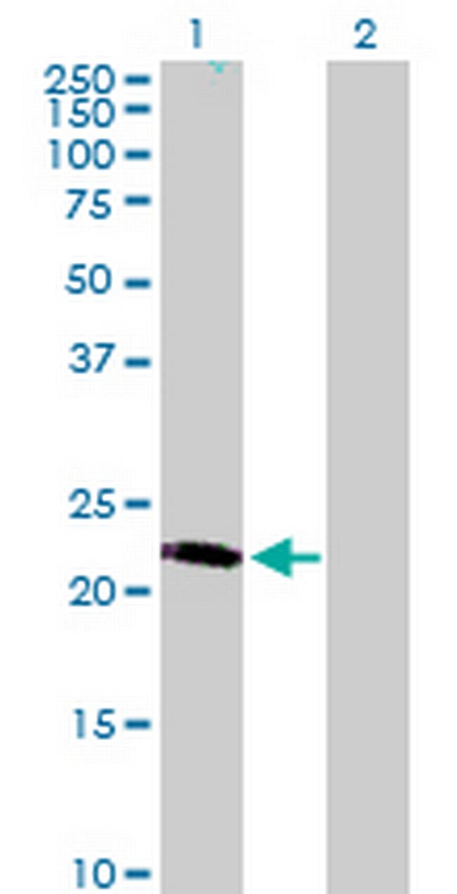 LRRC29 Antibody in Western Blot (WB)