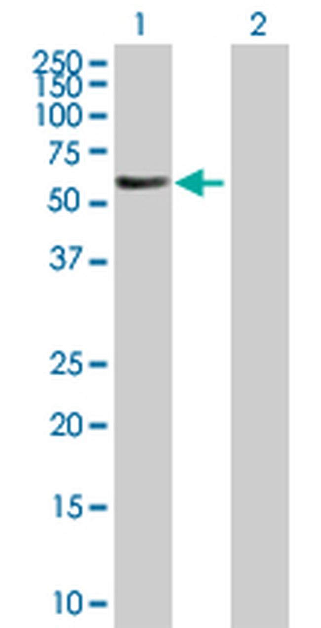 FBXL6 Antibody in Western Blot (WB)