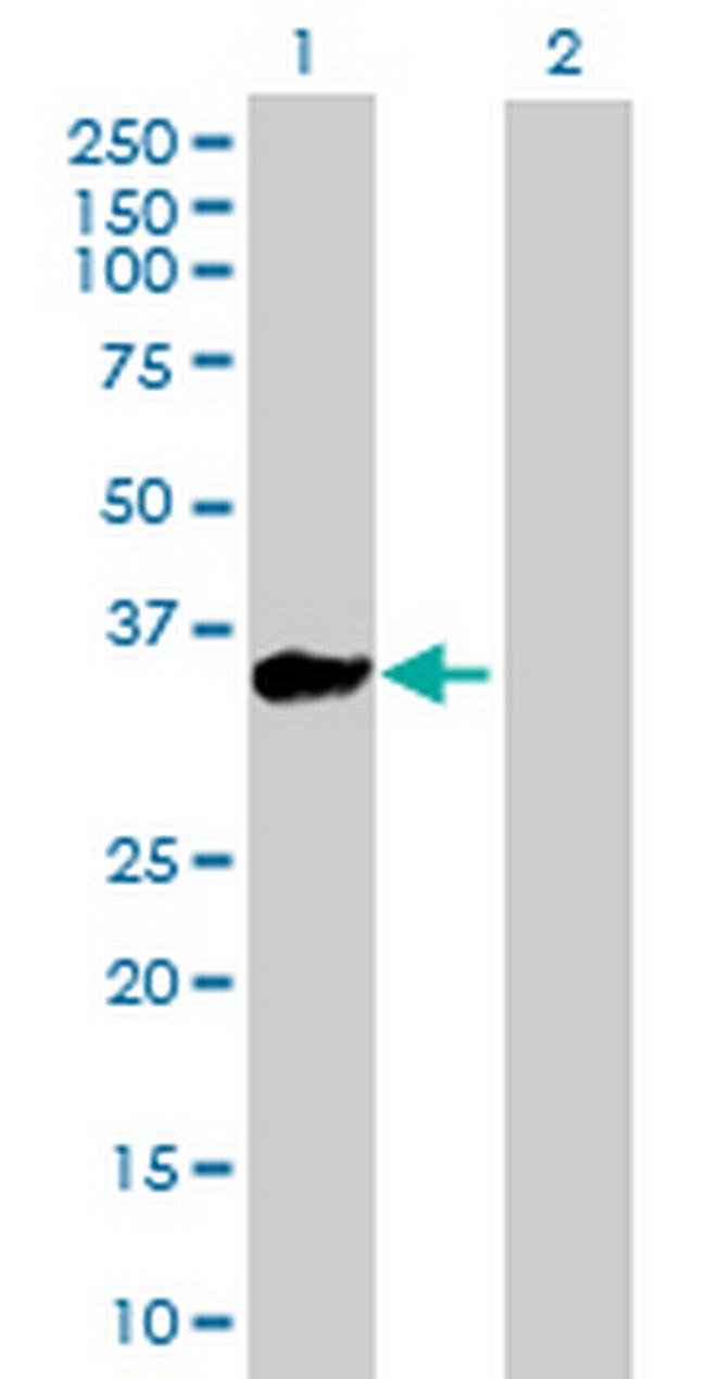 KLHL3 Antibody in Western Blot (WB)