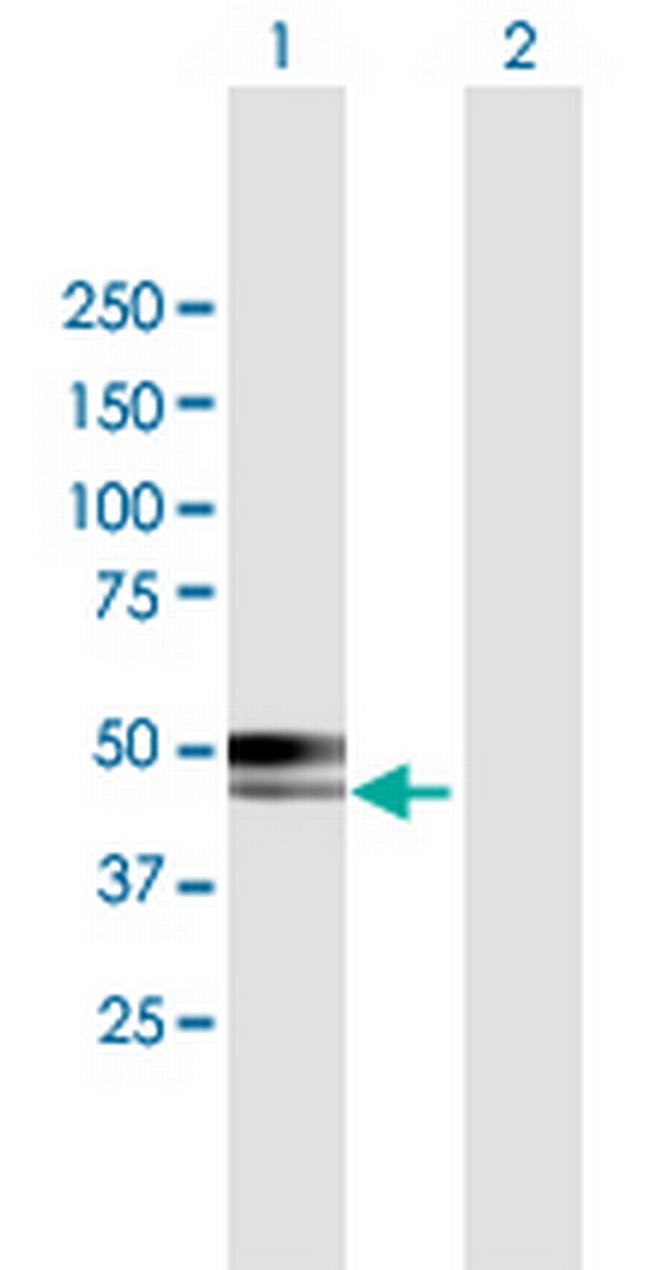 CABYR Antibody in Western Blot (WB)