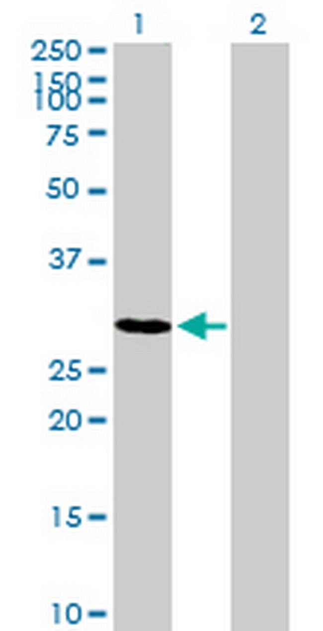 TSPAN17 Antibody in Western Blot (WB)