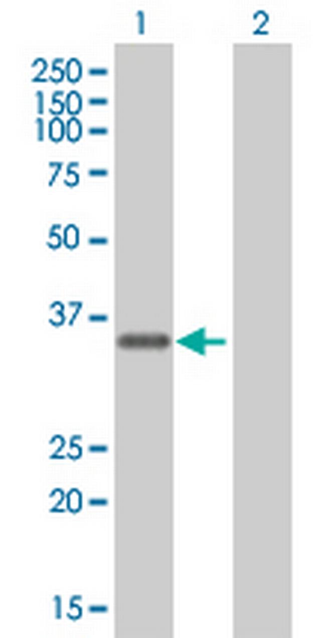 FBXO6 Antibody in Western Blot (WB)