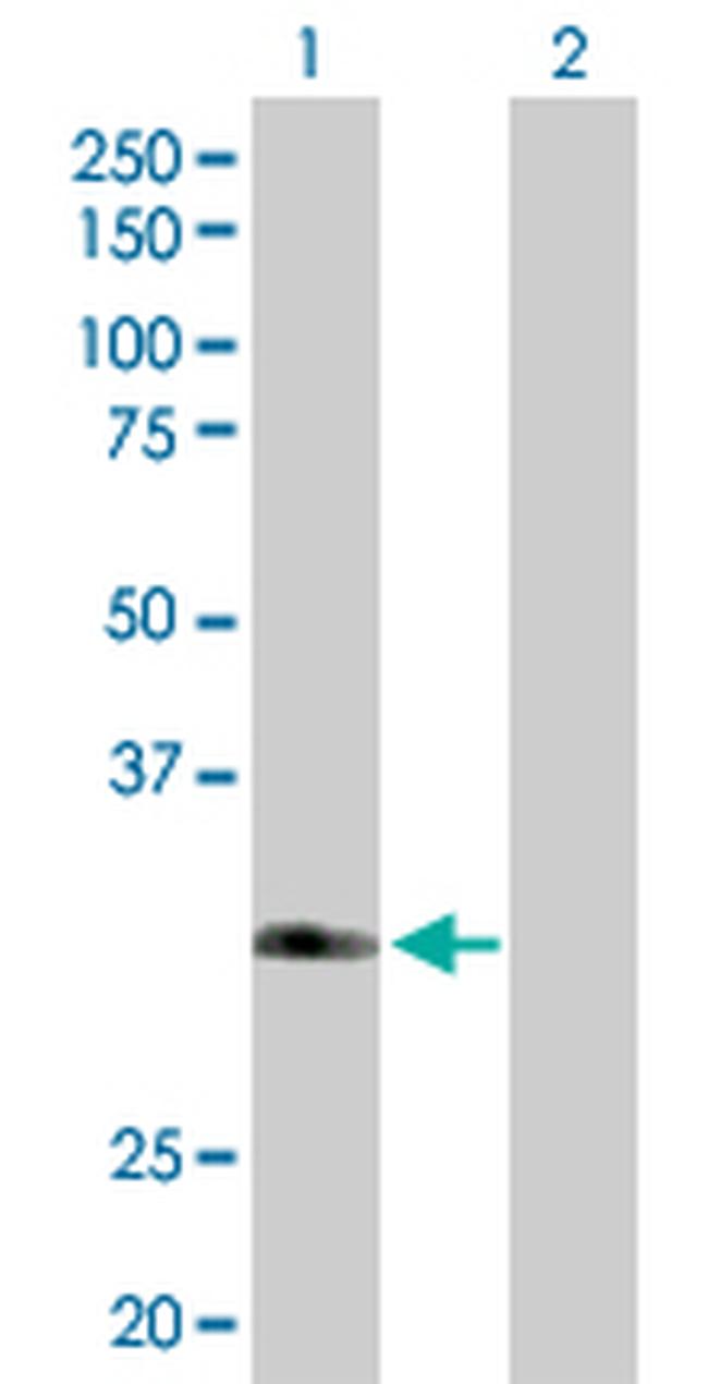 FBXO6 Antibody in Western Blot (WB)