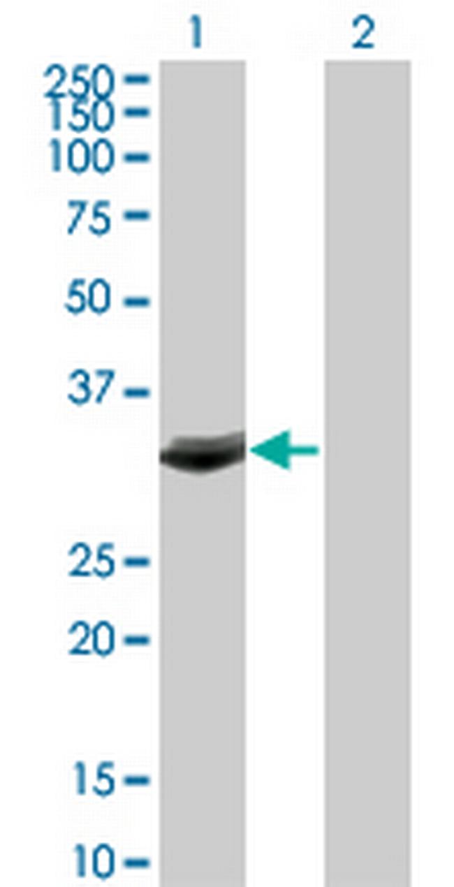 FBXO6 Antibody in Western Blot (WB)