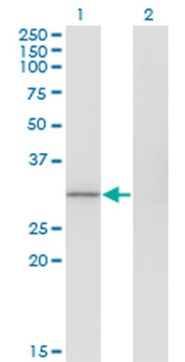 FBXO6 Antibody in Western Blot (WB)