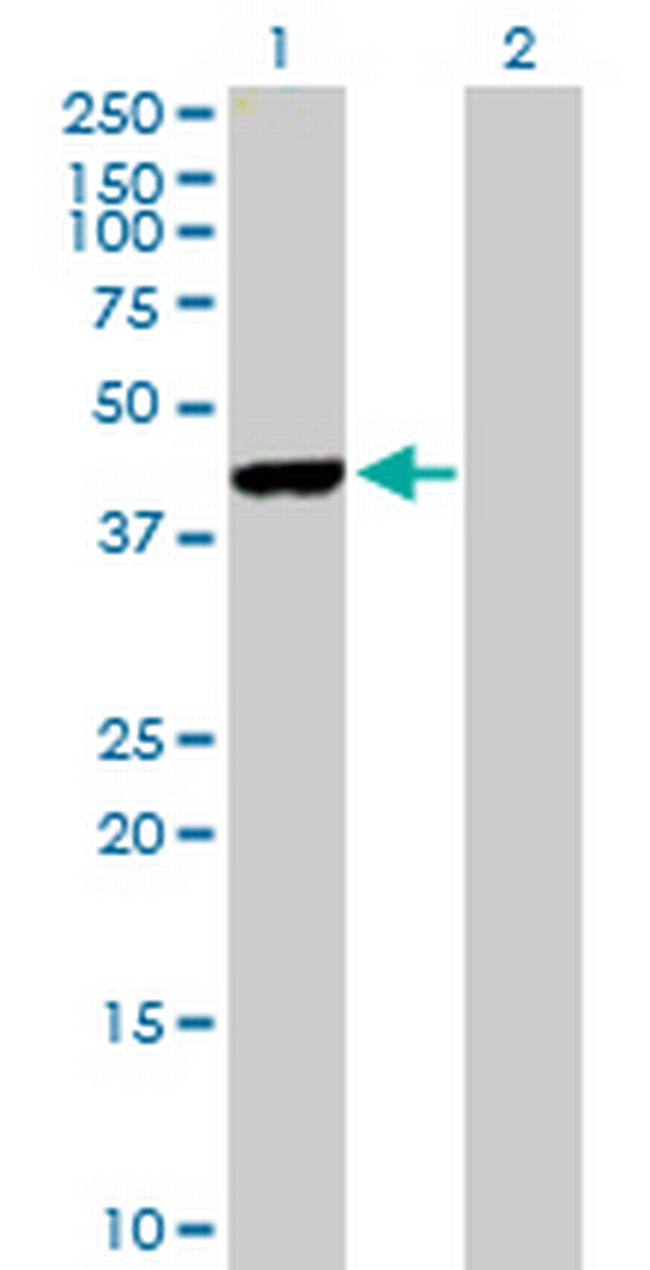 FBXO4 Antibody in Western Blot (WB)
