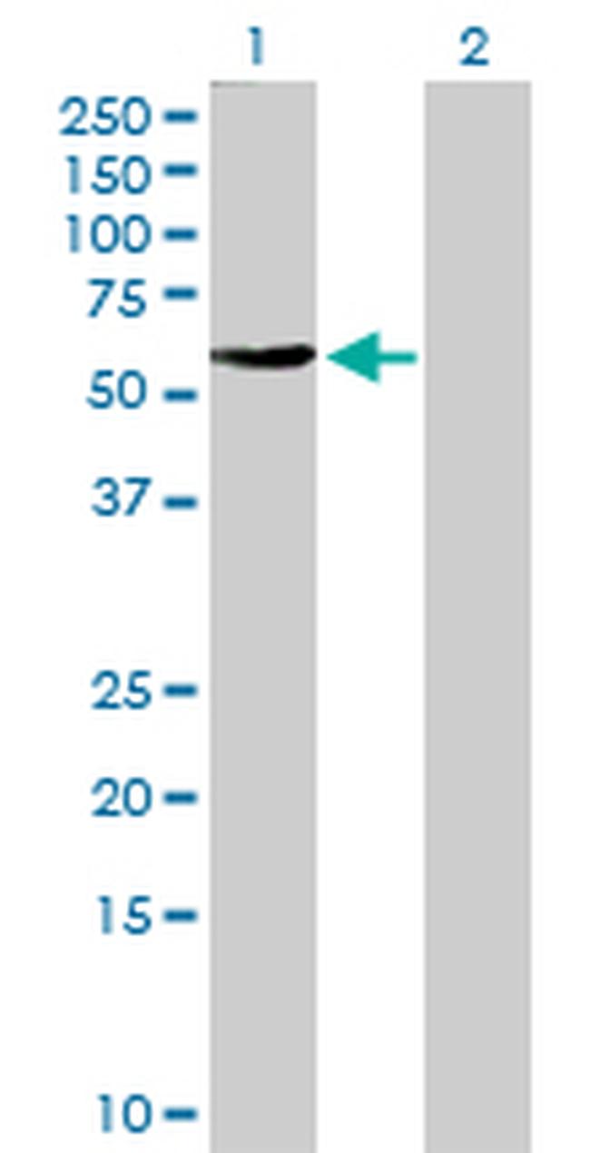 FBXO4 Antibody in Western Blot (WB)