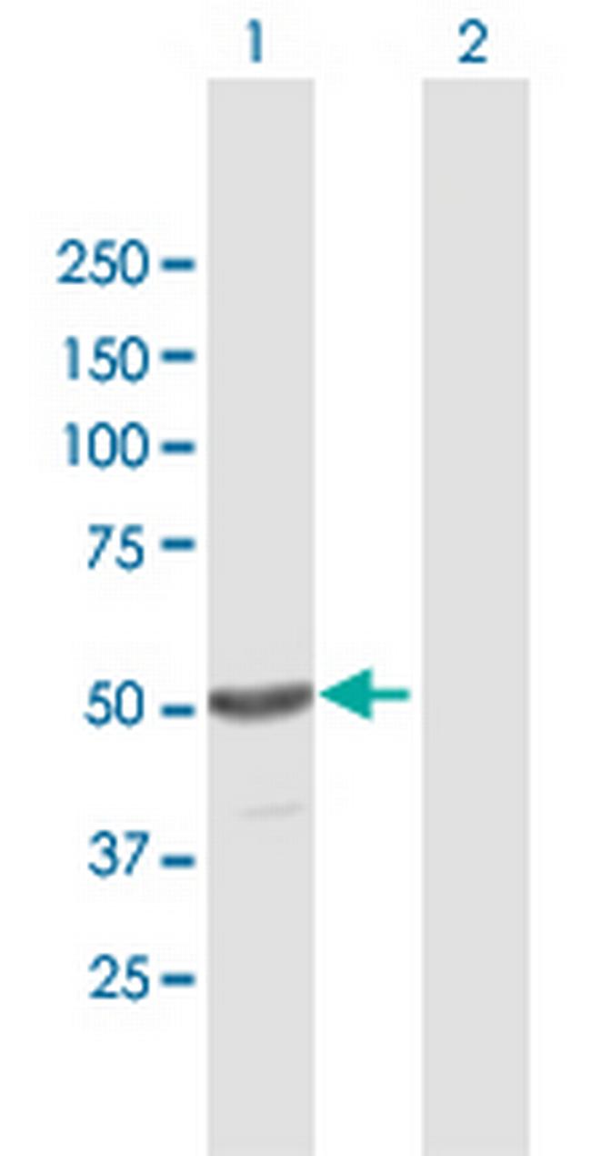 TINF2 Antibody in Western Blot (WB)