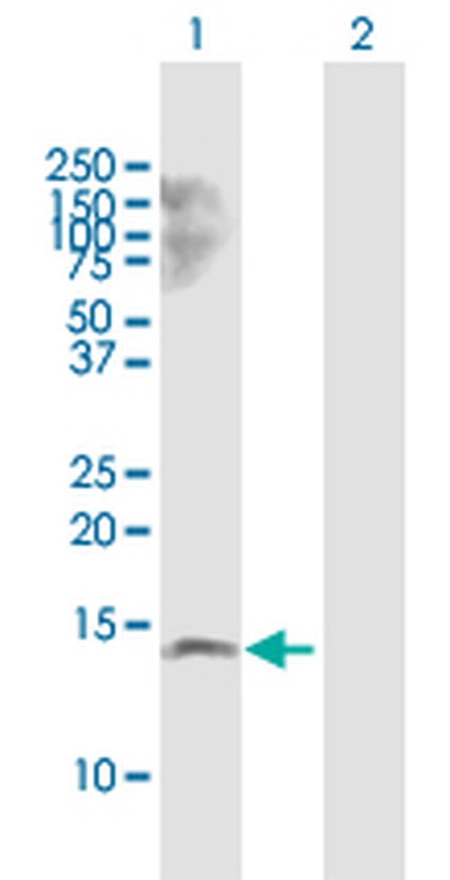 MYCBP Antibody in Western Blot (WB)