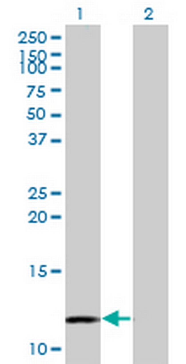 MYCBP Antibody in Western Blot (WB)