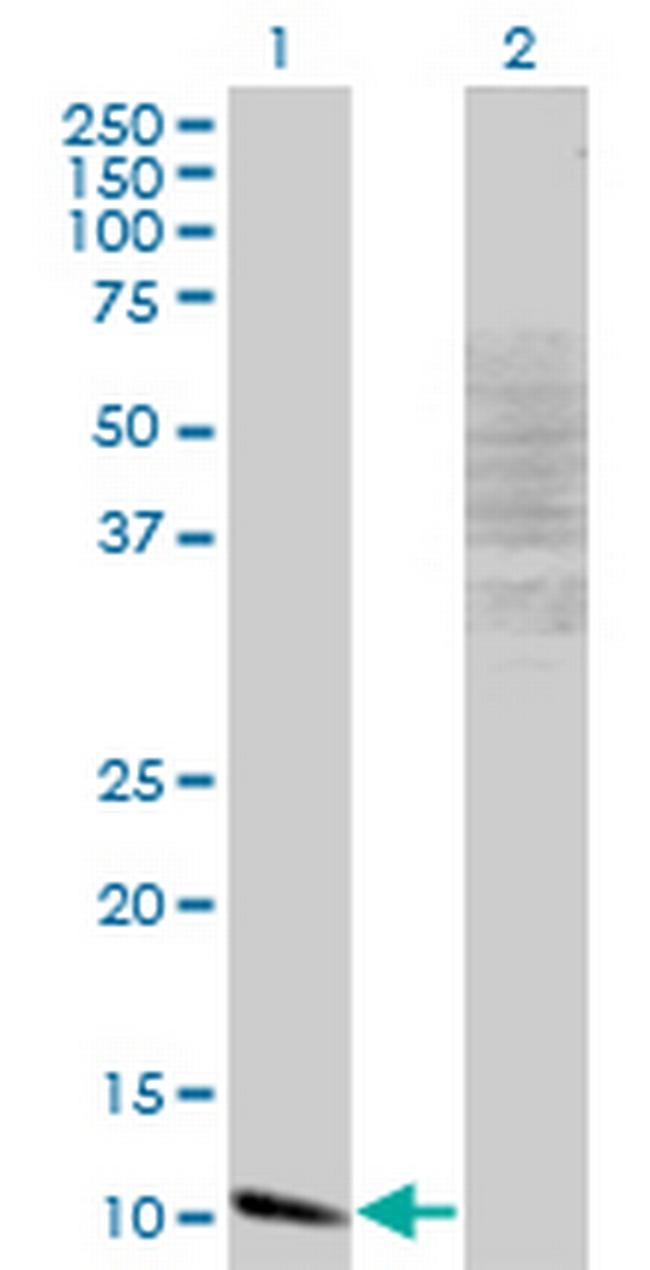 MYCBP Antibody in Western Blot (WB)