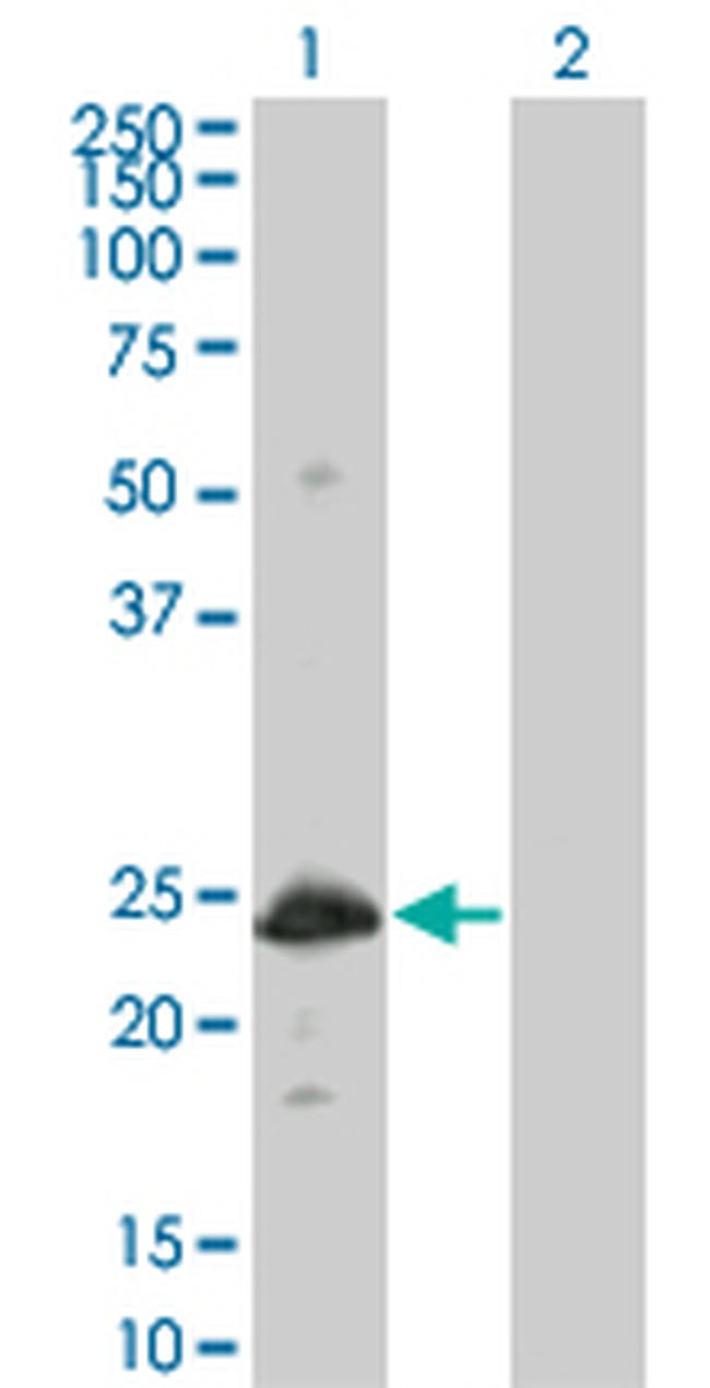 HSPB8 Antibody in Western Blot (WB)