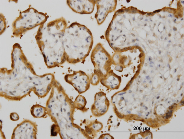 HSPB8 Antibody in Immunohistochemistry (Paraffin) (IHC (P))