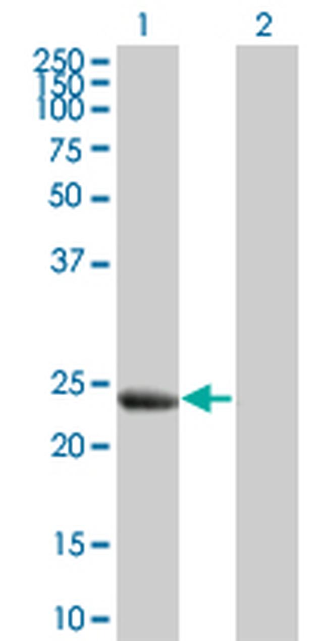 HSPB8 Antibody in Western Blot (WB)