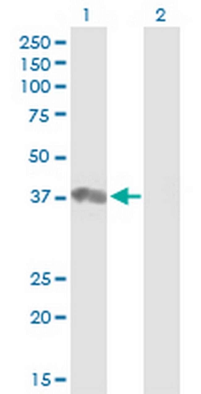 PTPN18 Antibody in Western Blot (WB)