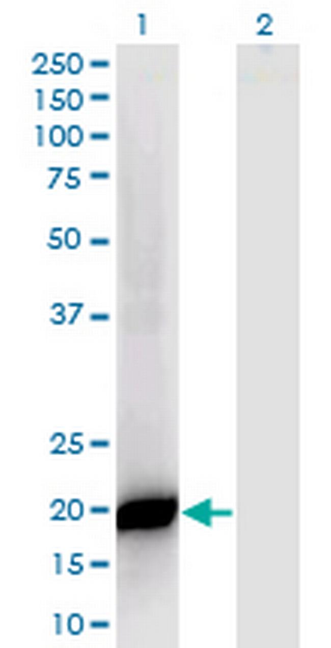 PPP1R14B Antibody in Western Blot (WB)