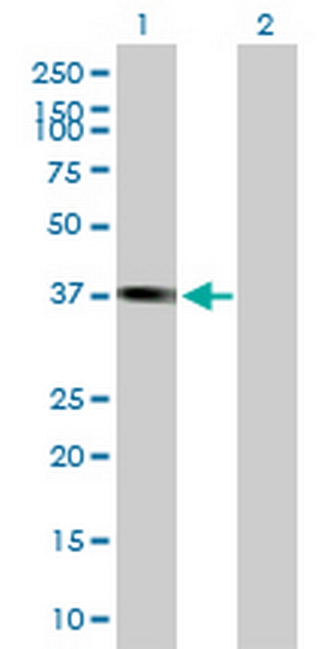 PLEK2 Antibody in Western Blot (WB)