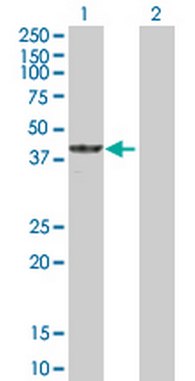 CNNM3 Antibody in Western Blot (WB)