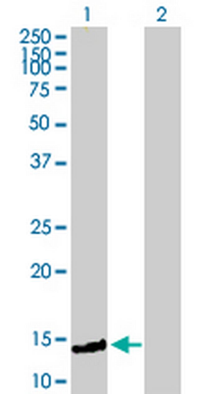 FXC1 Antibody in Western Blot (WB)