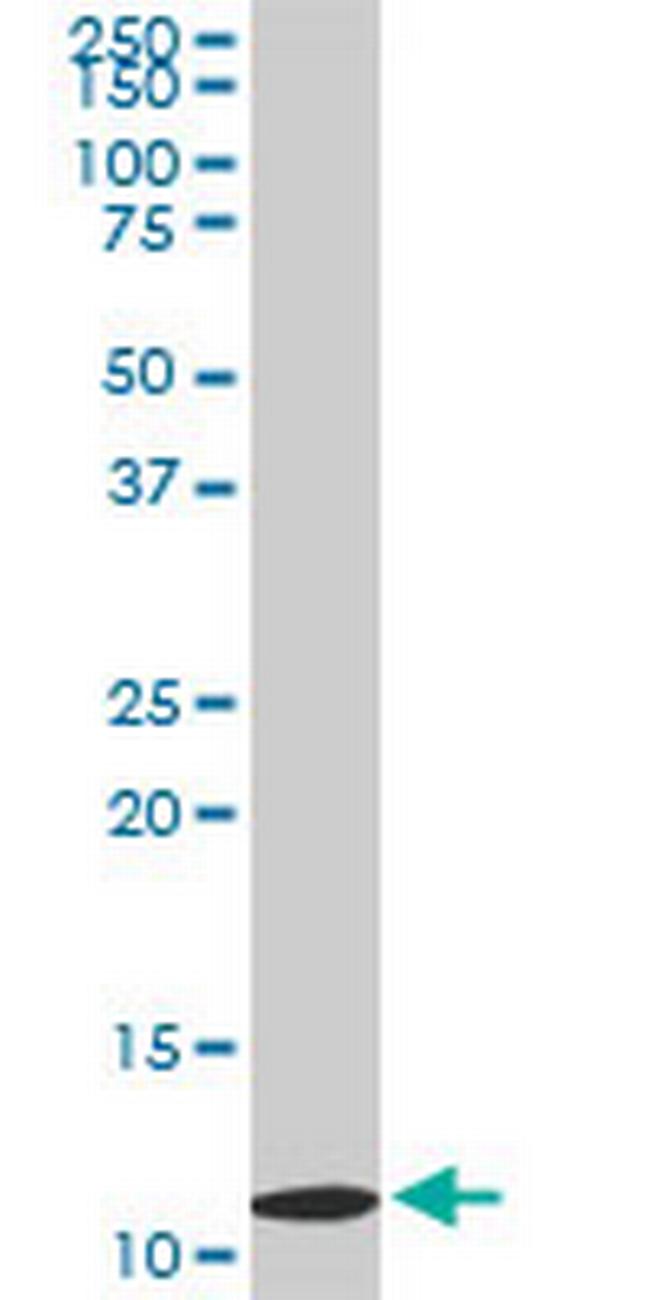 TIMM9 Antibody in Western Blot (WB)