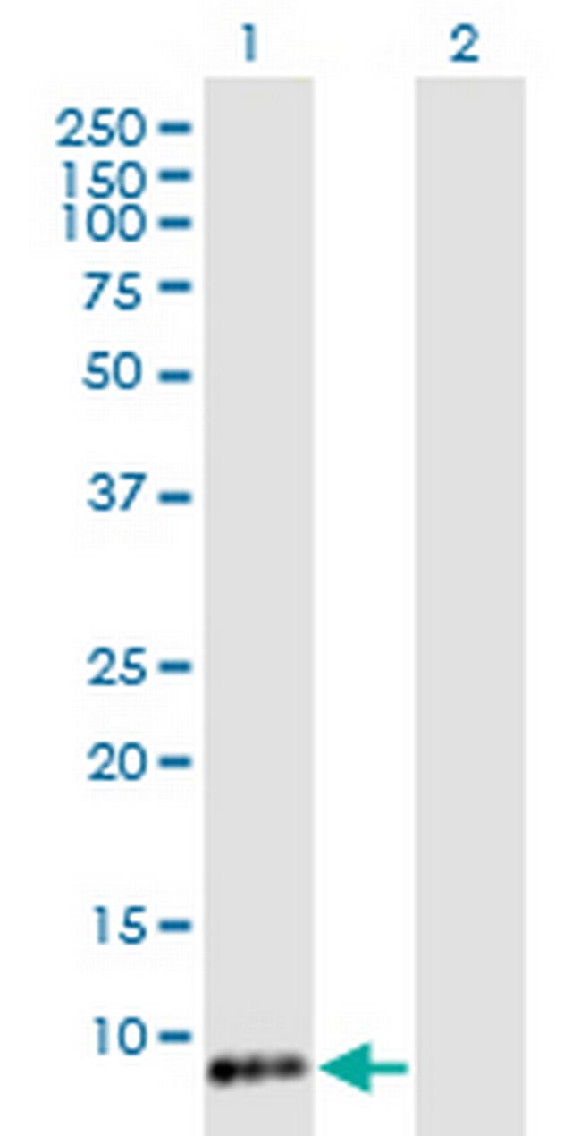 TIMM8B Antibody in Western Blot (WB)