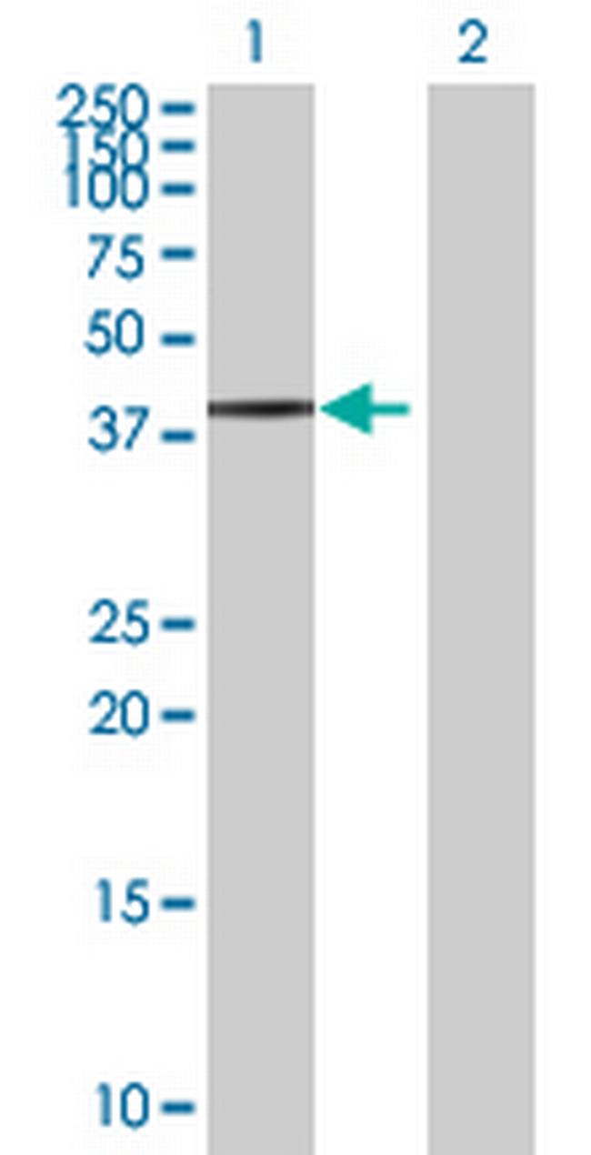 ITGB1BP2 Antibody in Western Blot (WB)