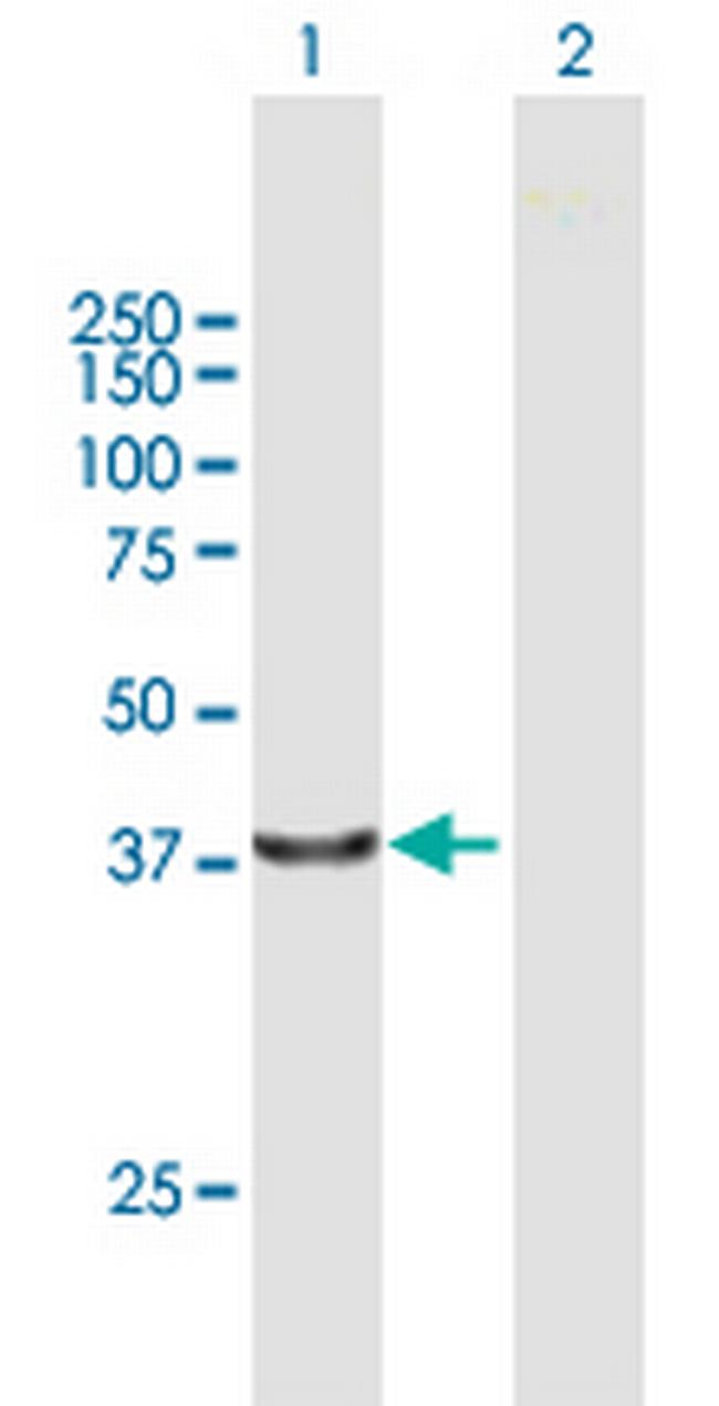 PCOLCE2 Antibody in Western Blot (WB)
