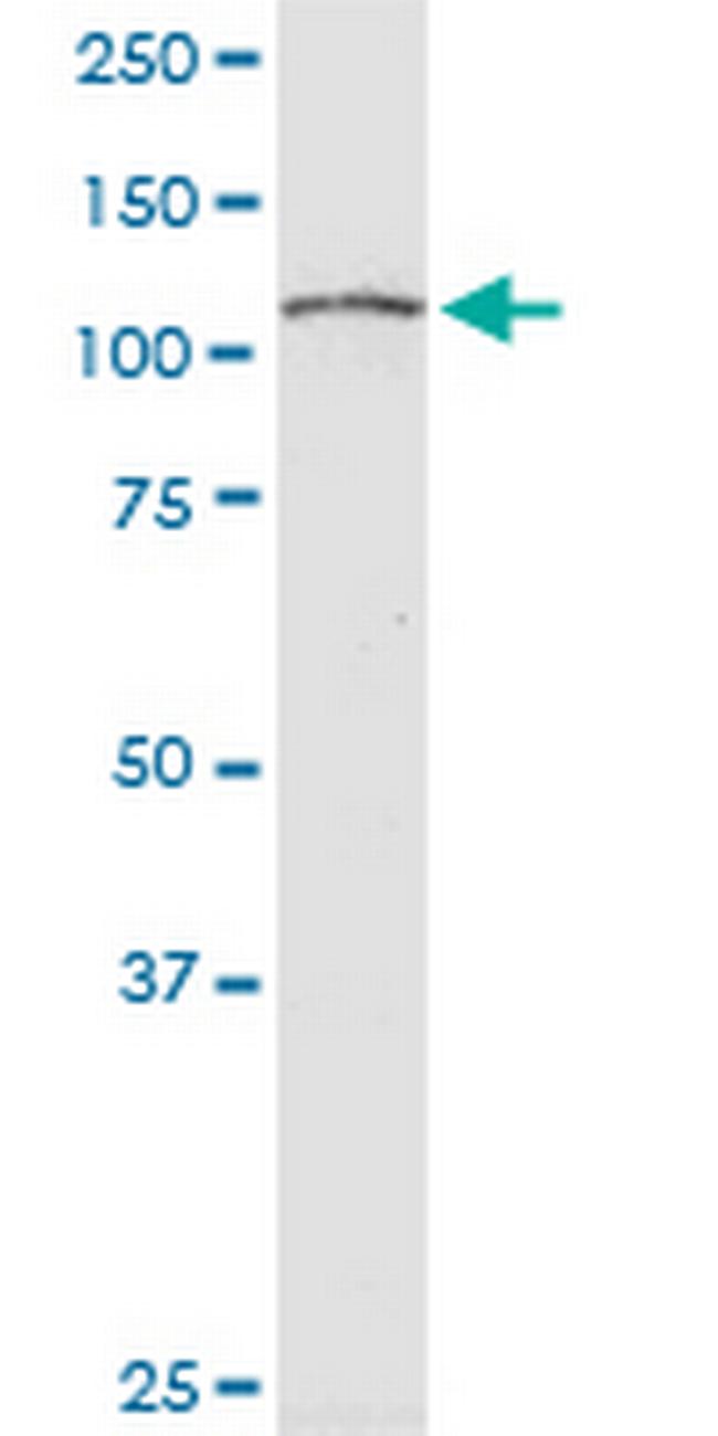 RPS6KC1 Antibody in Western Blot (WB)