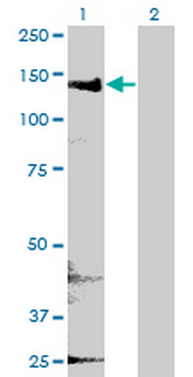 CYFIP2 Antibody in Western Blot (WB)
