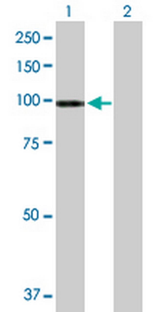 ATP2C1 Antibody in Western Blot (WB)