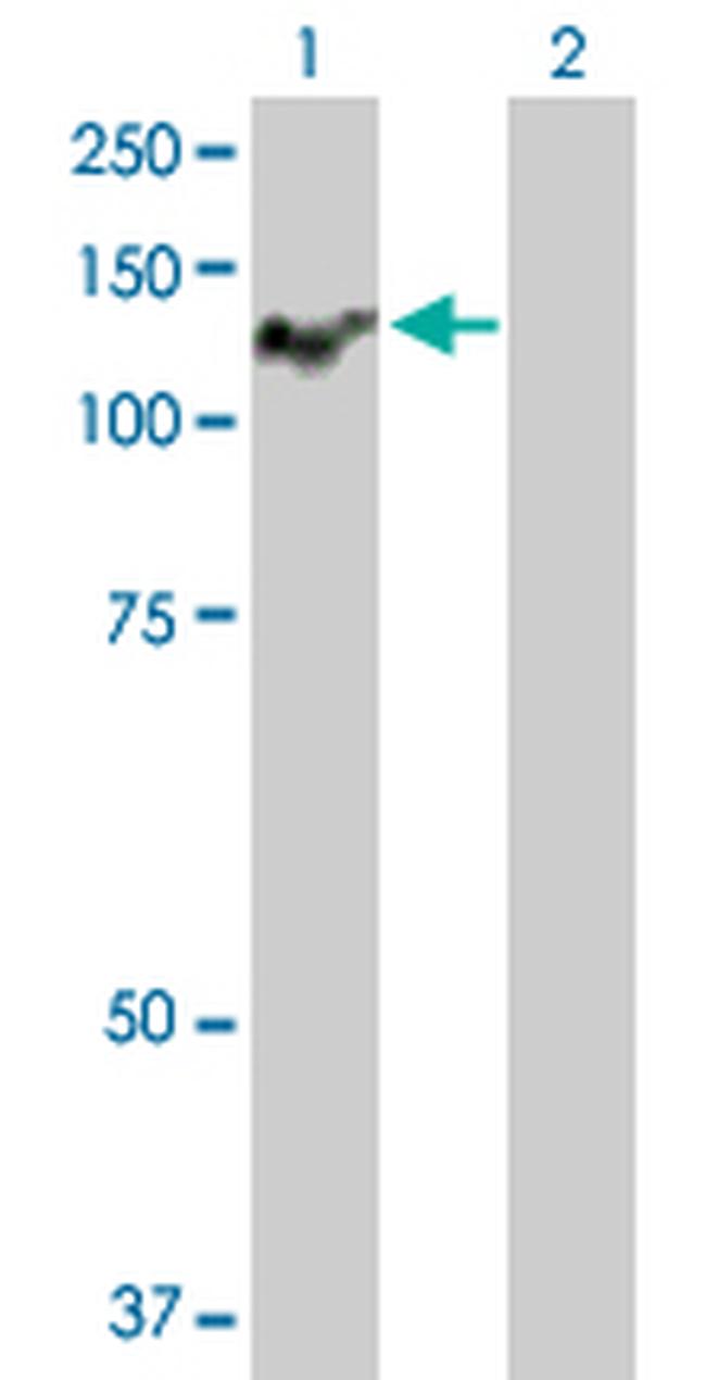 ATP2C1 Antibody in Western Blot (WB)