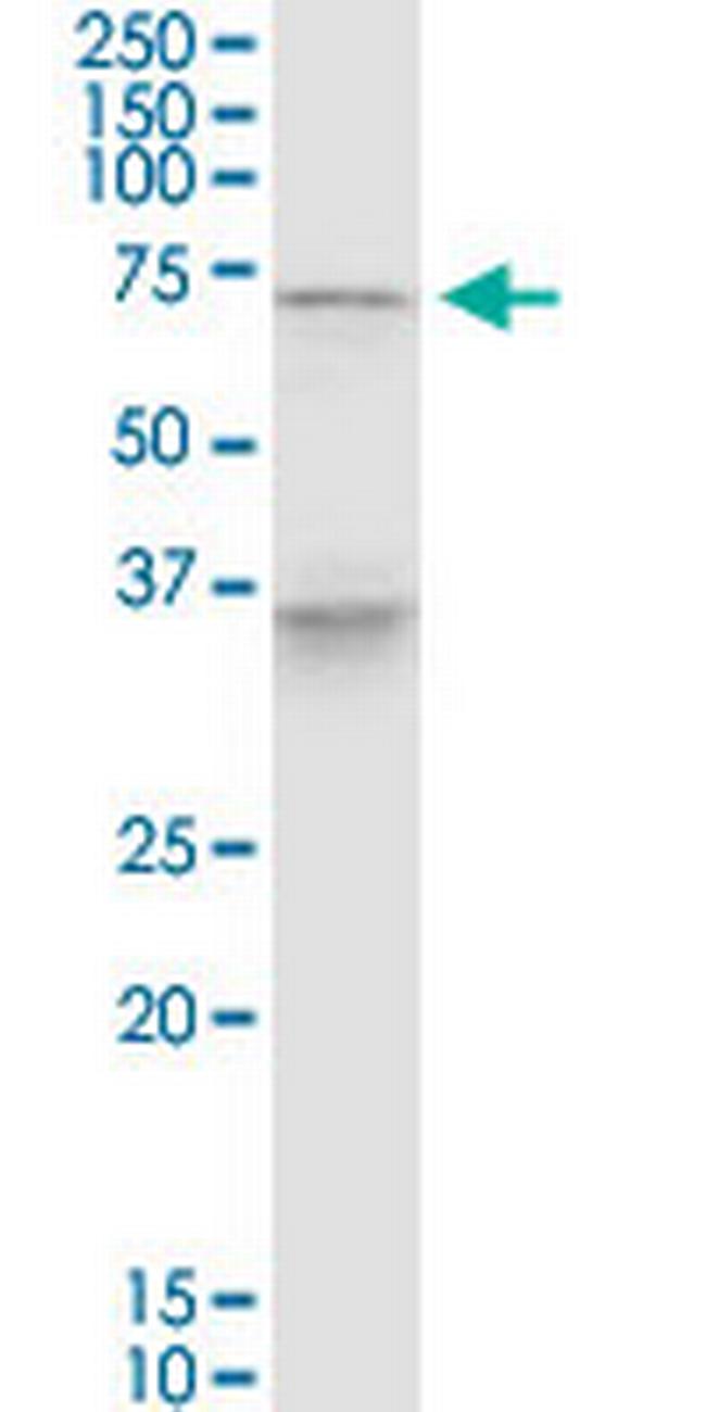 PELP1 Antibody in Western Blot (WB)