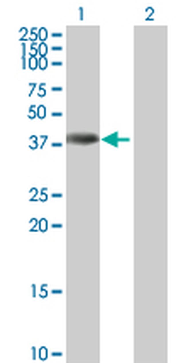 ANKRD1 Antibody in Western Blot (WB)