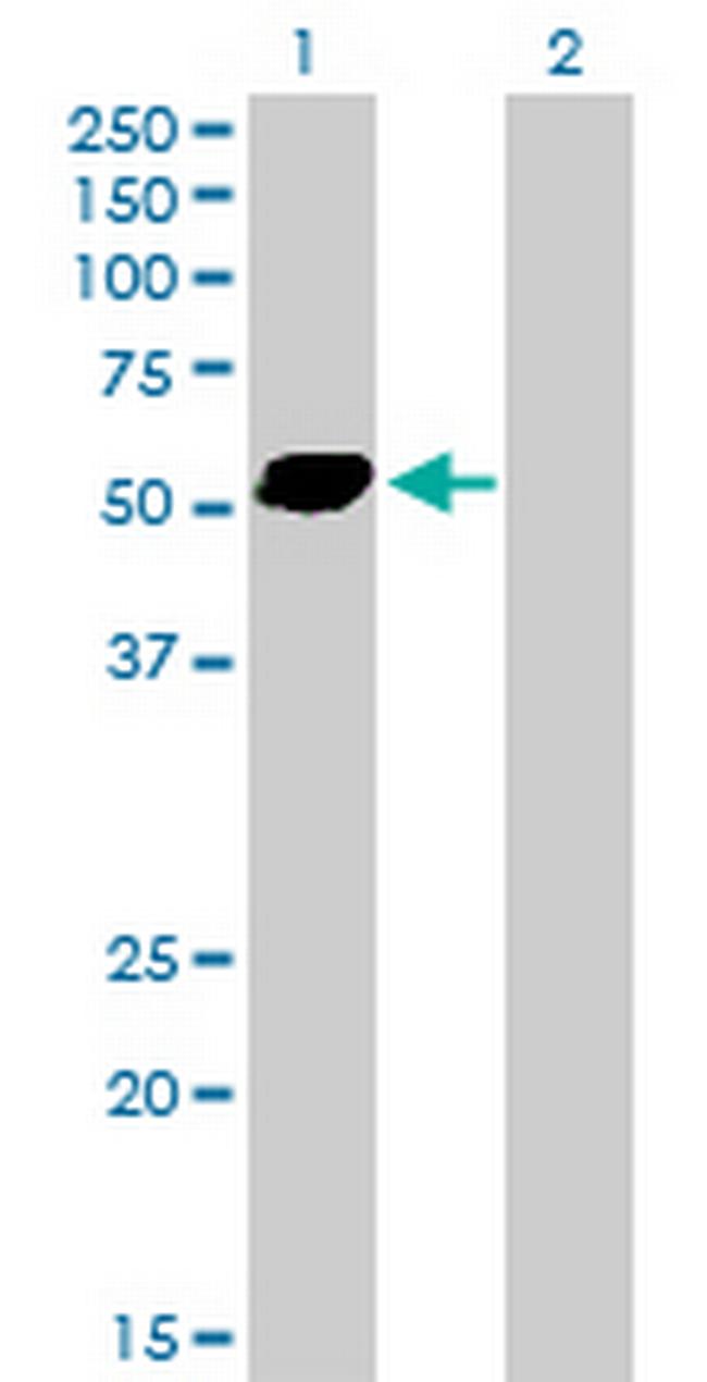 STAU2 Antibody in Western Blot (WB)