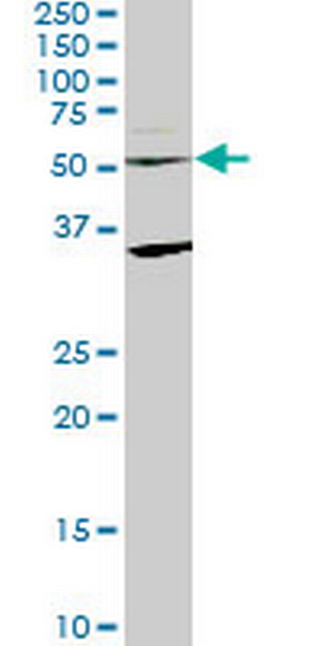 STAU2 Antibody in Western Blot (WB)