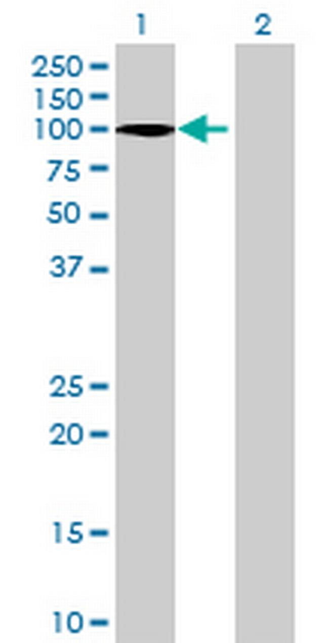 RPUSD2 Antibody in Western Blot (WB)