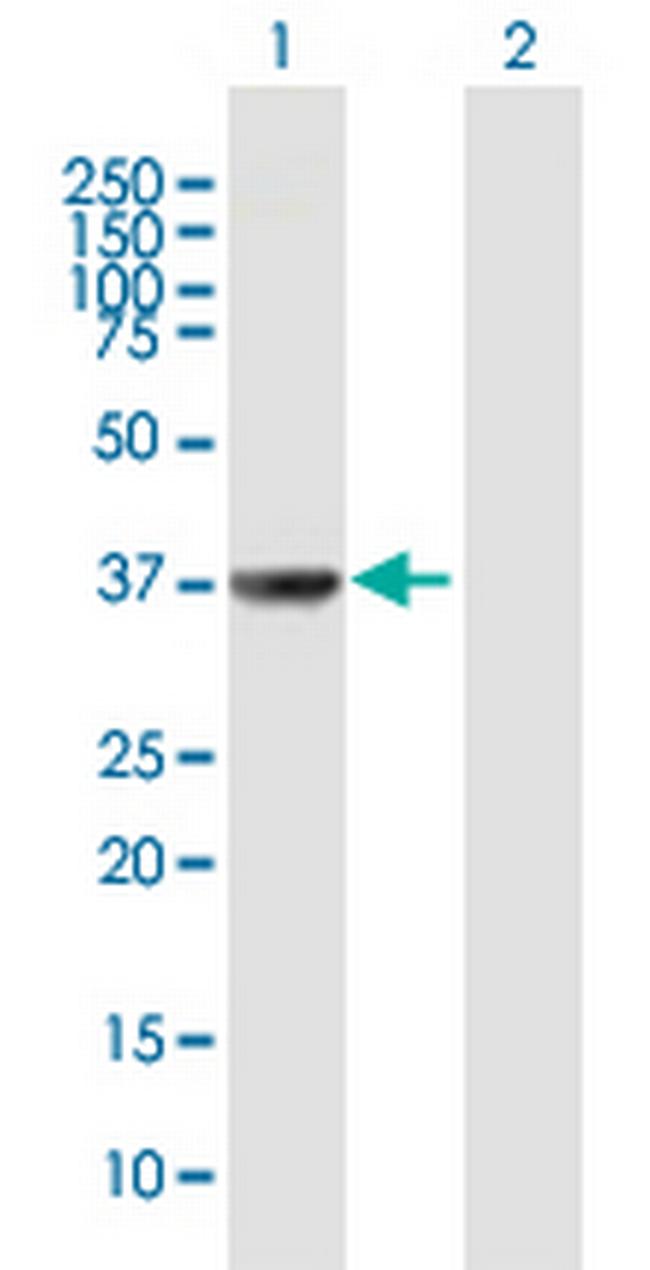 TAF5L Antibody in Western Blot (WB)