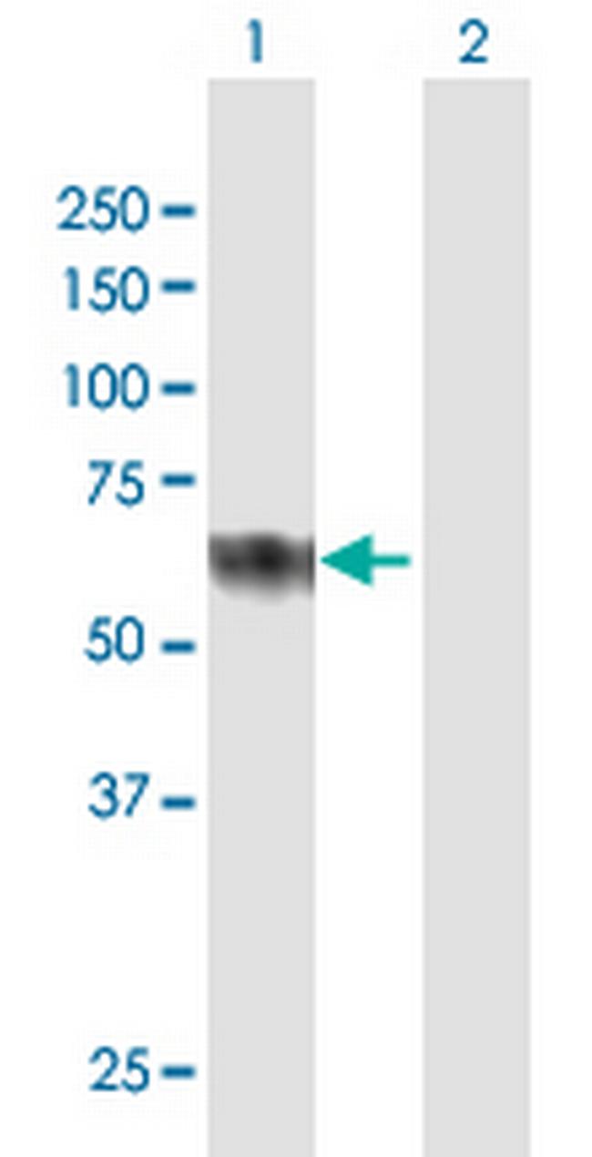 CLUL1 Antibody in Western Blot (WB)