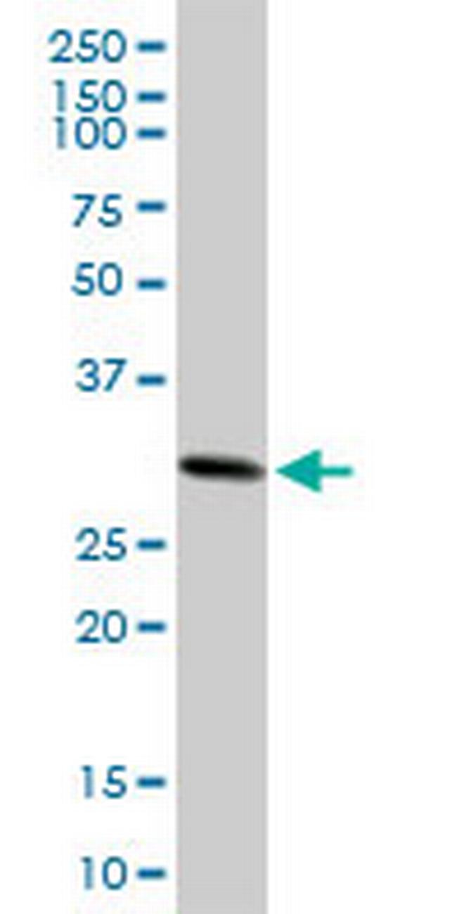 CACYBP Antibody in Western Blot (WB)