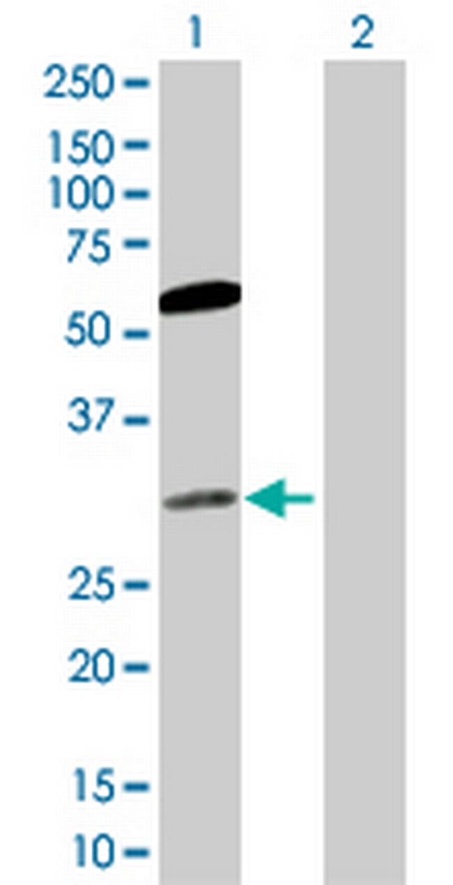 CACYBP Antibody in Western Blot (WB)