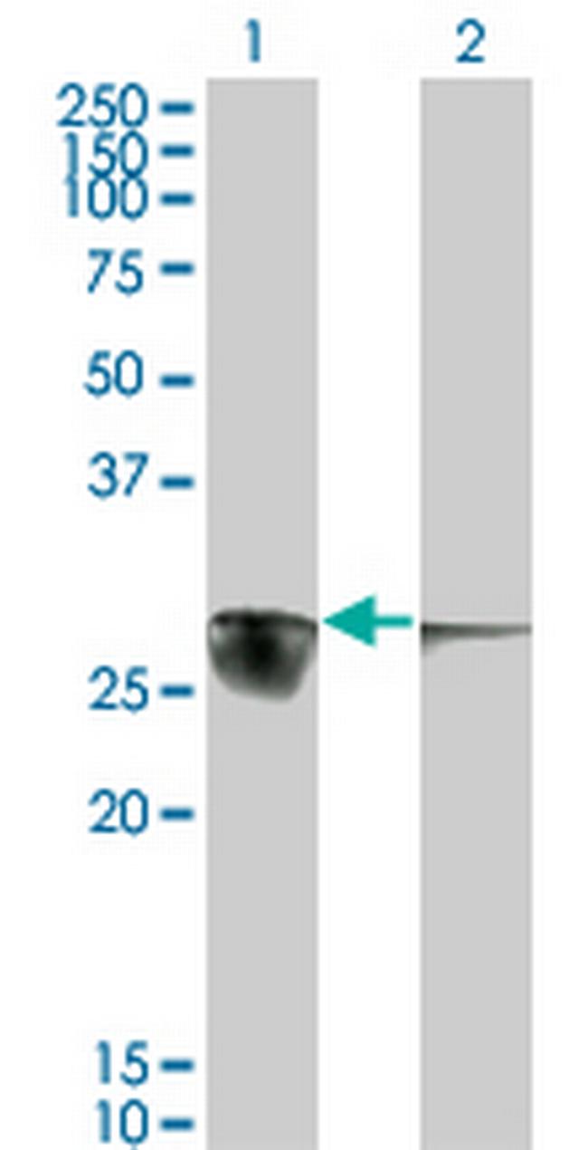 CACYBP Antibody in Western Blot (WB)