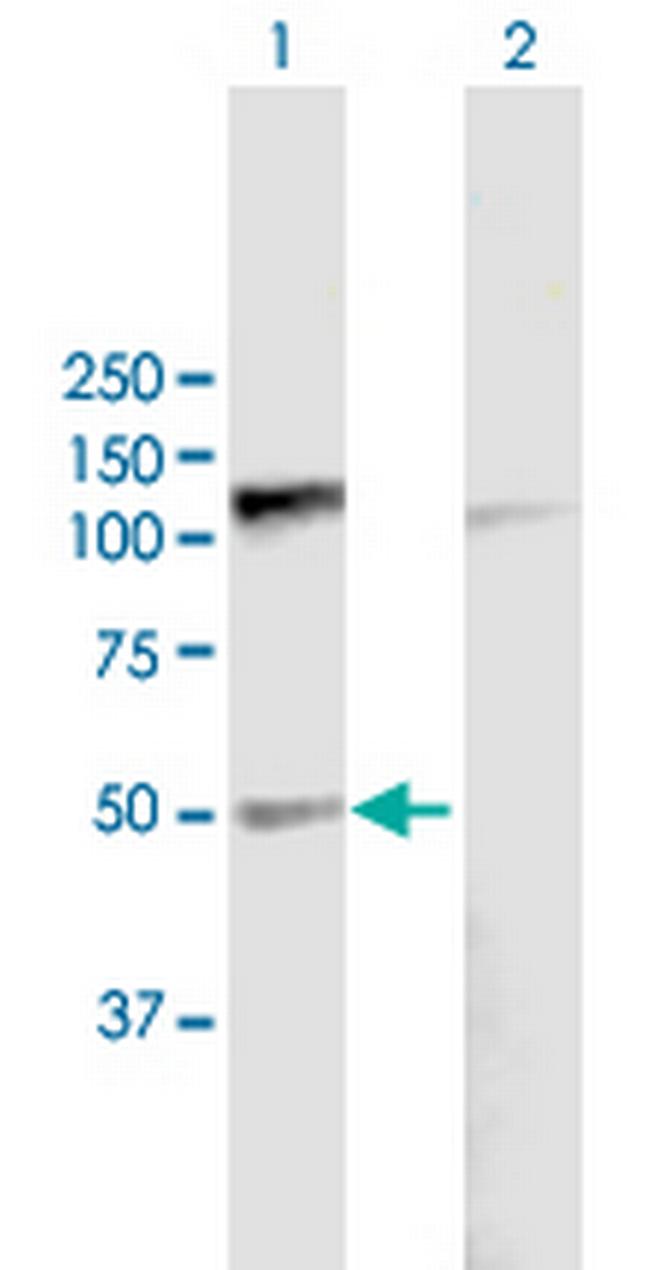 PDE7B Antibody in Western Blot (WB)