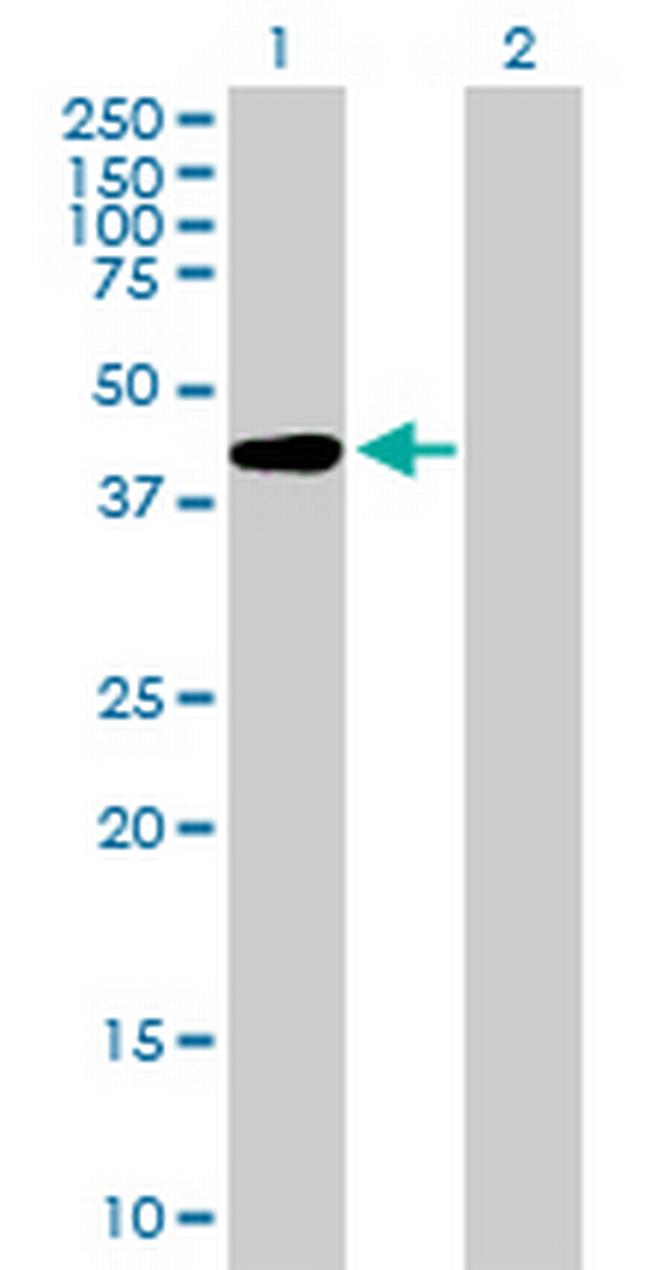 AFF4 Antibody in Western Blot (WB)