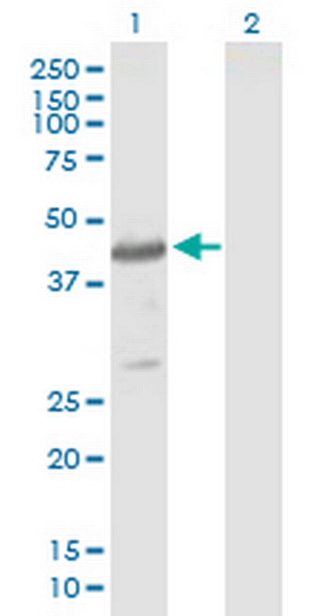 CYTH4 Antibody in Western Blot (WB)