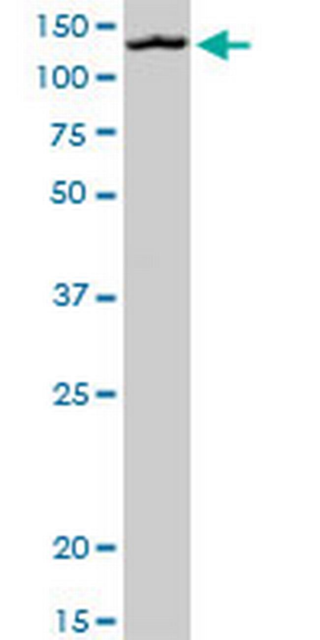 MORC1 Antibody in Western Blot (WB)