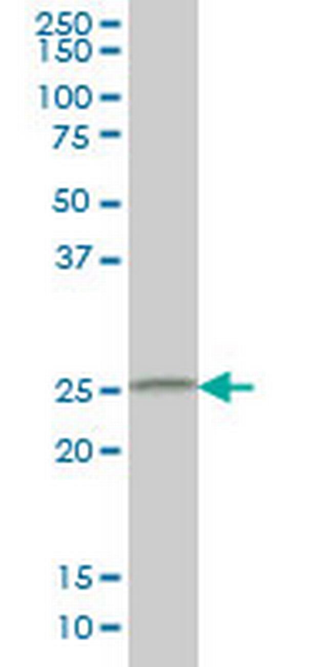 CIDEB Antibody in Western Blot (WB)