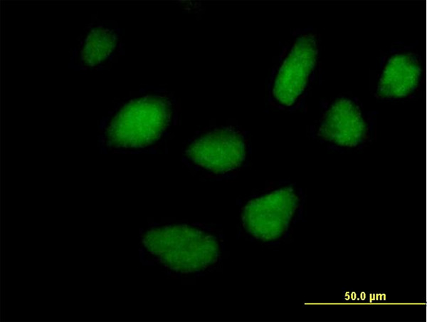 STK36 Antibody in Immunocytochemistry (ICC/IF)